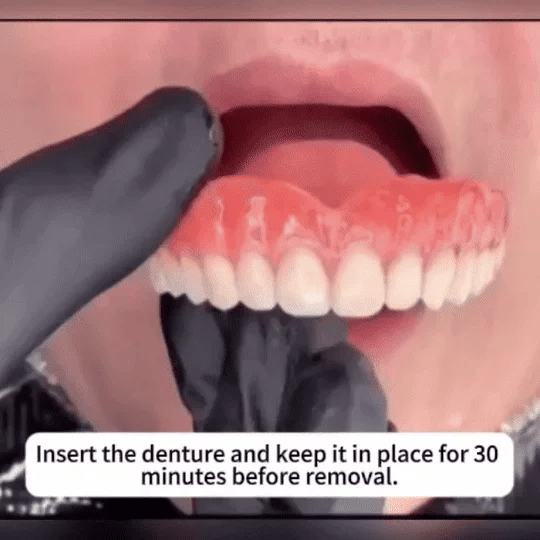 (OFFICIAL STORE) Medazy ™ Custom-Fit Full Functional Dentures