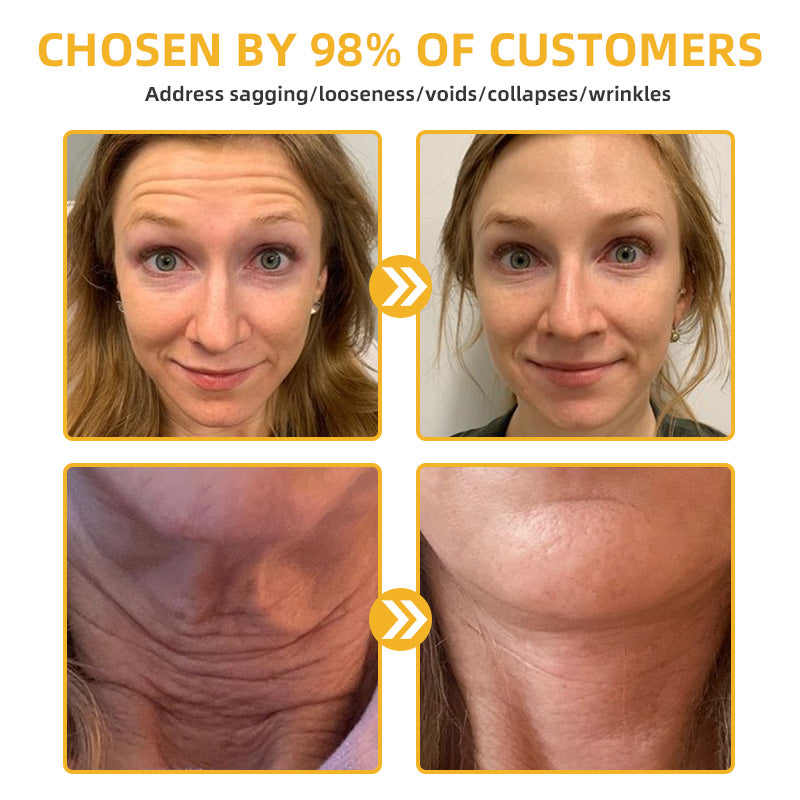💐💞Lovilds™ BeeLift Anti-Aging Firming Cream,Address Crepe & Sagging(🔥60% Off for a Limited Time!)