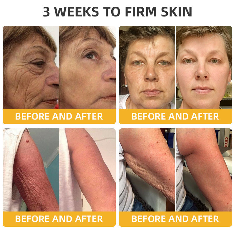 💐💞Lovilds™ BeeLift Anti-Aging Firming Cream,Address Crepe & Sagging(🔥60% Off for a Limited Time!)