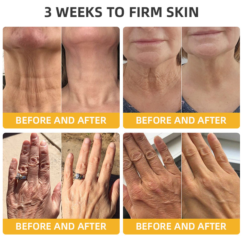 💐💞Lovilds™ BeeLift Anti-Aging Firming Cream,Address Crepe & Sagging(🔥60% Off for a Limited Time!)