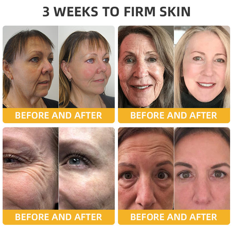 💐💞Lovilds™ BeeLift Anti-Aging Firming Cream,Address Crepe & Sagging(🔥60% Off for a Limited Time!)