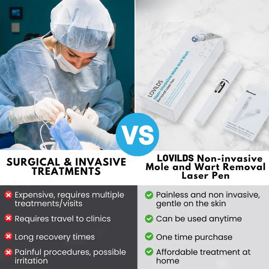 š„LOVILDS⢠Non-Invasive Mole and Wart Removal Laser Pen