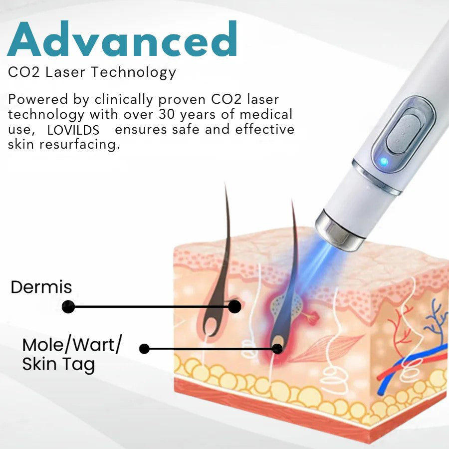 š„LOVILDS⢠Non-Invasive Mole and Wart Removal Laser Pen