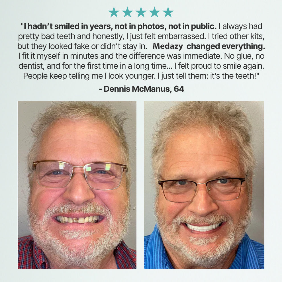 (OFFICIAL STORE) Medazy ™ Custom-Fit Full Functional Dentures
