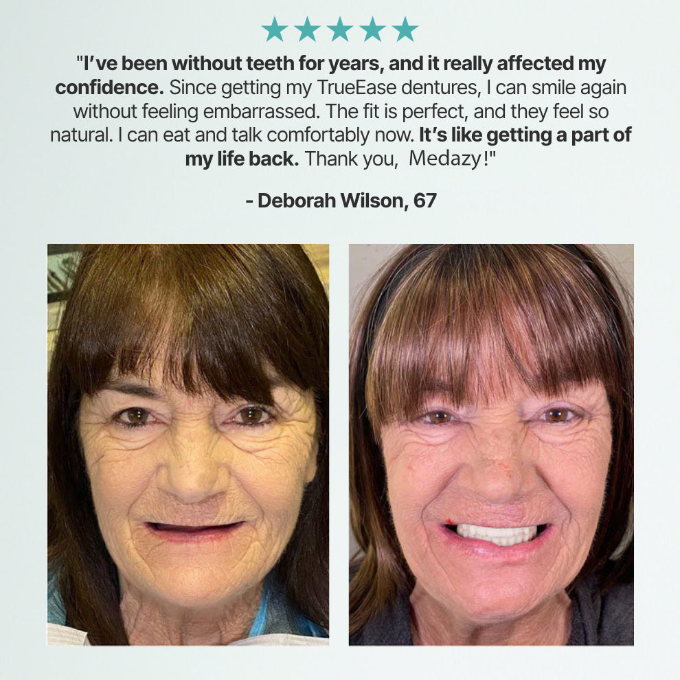 (OFFICIAL STORE) Medazy ™ Custom-Fit Full Functional Dentures