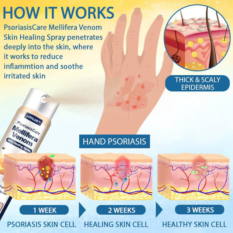 LOVILDS® PsoriasisCare Mellifera Venom Skin Healing Spray🔥