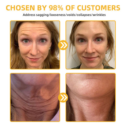 💐💞Lovilds™ BeeLift Anti-Aging Firming Cream,Address Crepe & Sagging(🔥60% Off for a Limited Time!)