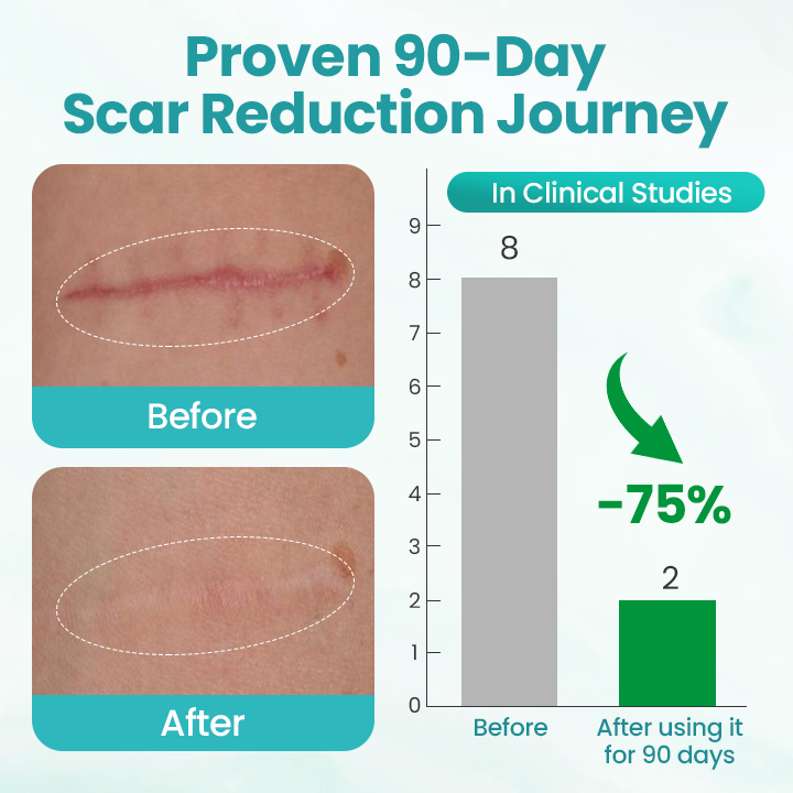 BBOJI® EliteAloe ScarSolve Spray