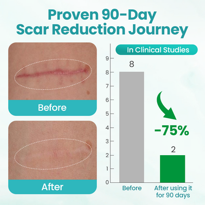 BBOJI® EliteAloe ScarSolve Spray