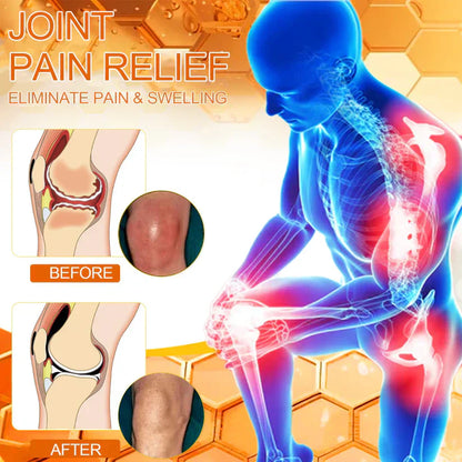 LOVILDS™ Bee poison Pain Relief and Bone Care Ointment