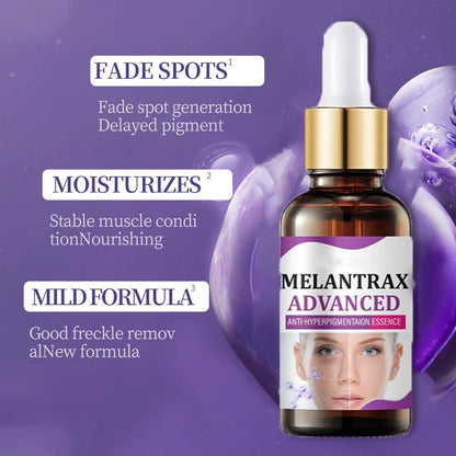 10% Niacinamide Spots Removal Serum 🎉Second Item half price🎉