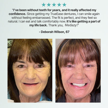 （OFFICIAL STORE） Medazy ™ Custom-Fit Full Functional Dentures